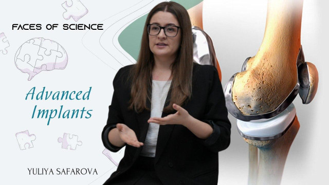 Yuliya Safarova. Advanced Implants